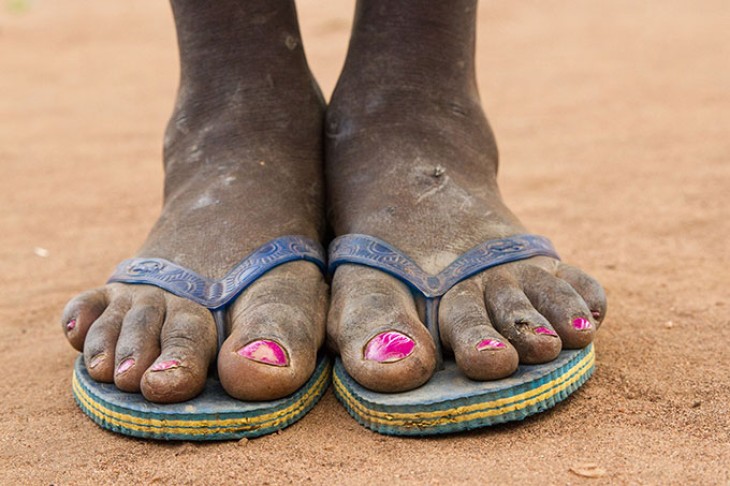 Fødder i sandaler - Imvepi flygtningelejren, Uganda